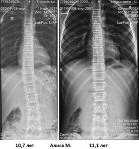 2018 07 06 merzlenko